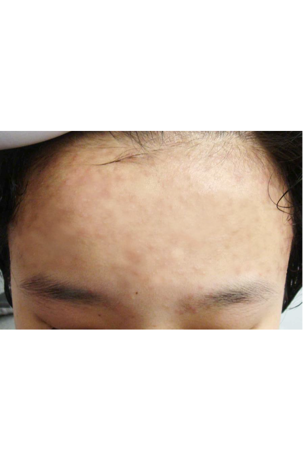 After