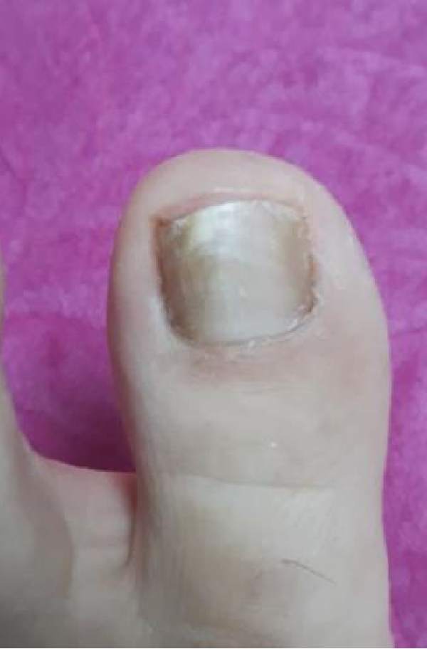 After