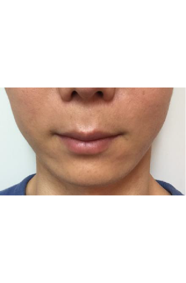 After