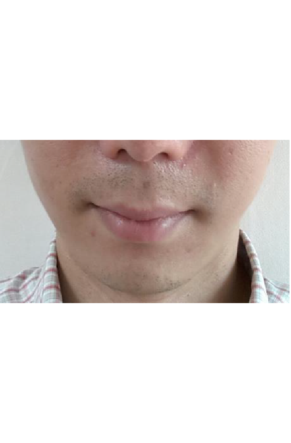 Before